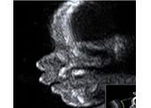 Perfil de cara fetal